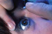 Cuidado con los ojos en el invierno
